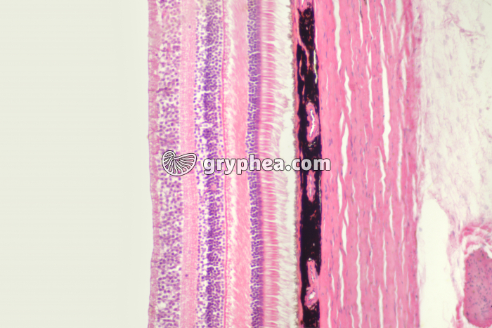 Rétine, choroïde et sclérotique CT x40 - gryphea.org